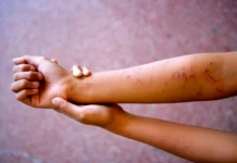 Unicef: El 63% de los niños dominicanos ha sufrido violencia en el hogar o escuela